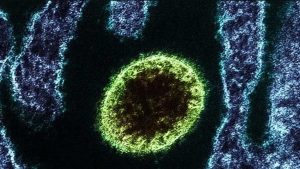 Científicos asiáticos hallaron 35 infecciones por un nuevo virus, bautizado Langya
